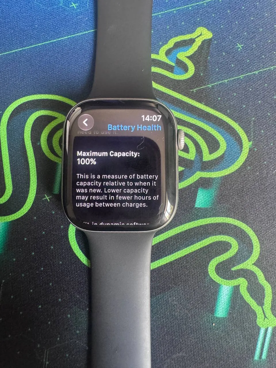 Apple Watch Series 11 46 мм GPS 1
